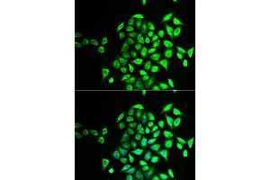 Immunofluorescence analysis of U2OS cells using NAPG antibody (ABIN5973832). (NAPG Antikörper)