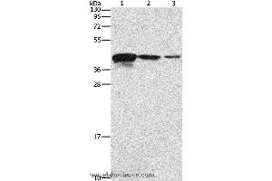 Western blot analysis of Human endometrial carcinoma tissue, A172 and U937 cell, using TWF2 Polyclonal Antibody at dilution of 1:800