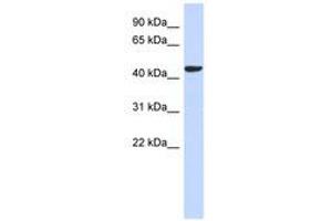 Image no. 1 for anti-Sphingomyelin Synthase 2 (SGMS2) (AA 71-120) antibody (ABIN6741220) (Sphingomyelin Synthase 2 Antikörper  (AA 71-120))