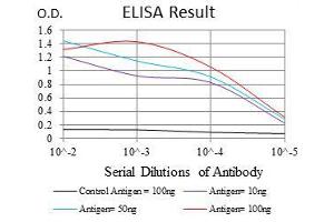 Black line: Control Antigen (100 ng), Purple line: Antigen(10 ng), Blue line: Antigen (50 ng), Red line: Antigen (100 ng), (Glucose-6-Phosphate Dehydrogenase Antikörper)