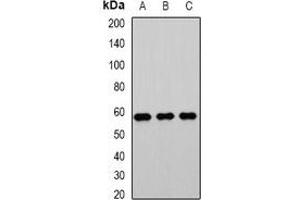 Western blot analysis of PHACS expression in Jurkat (A), mouse testis (B), rat kidney (C) whole cell lysates. (PHACS Antikörper)