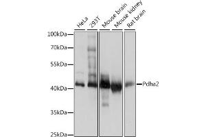 Western blot analysis of extracts of various cell lines, using Pdha2 antibody (ABIN7269770) at 1:1000 dilution. (PDHA2 Antikörper  (AA 230-391))