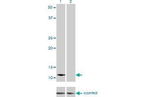 Western blot analysis of ACYP2 over-expressed 293 cell line, cotransfected with ACYP2 Validated Chimera RNAi (Lane 2) or non-transfected control (Lane 1). (Acyp2 Antikörper  (AA 1-98))