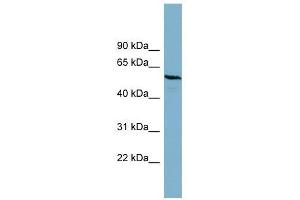 PGM3 antibody used at 1 ug/ml to detect target protein. (Phosphoglucomutase 3 Antikörper  (Middle Region))