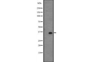 Western blot analysis of KLF14 expression in A431 whole cell lysate ,The lane on the left is treated with the antigen-specific peptide. (KLF14 Antikörper  (C-Term))