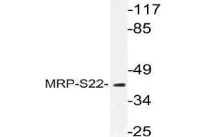 Western blot (WB) analysis of MRP-S22 antibody in extracts from COS cells. (MRPS22 Antikörper)