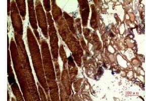 Immunohistochemistry (IHC) image for anti-MutY Homolog (E. Coli) (MUTYH) (pan) antibody (ABIN3187926)