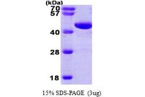 SDS-PAGE (SDS) image for Phosphoglycerate Kinase 1 (PGK1) (AA 1-417) protein (His tag) (ABIN666782) (PGK1 Protein (AA 1-417) (His tag))