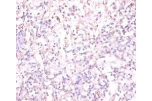 Immunohistochemistry of paraffin-embedded human spleen tissue using ABIN7170878 at dilution of 1:100 (TACR1 Antikörper  (AA 1-29))