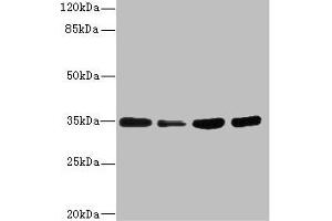 Western blot All lanes: UFD1 antibody at 3. (UFD1L Antikörper  (AA 1-307))