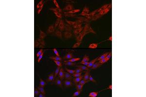 Immunofluorescence (IF) image for anti-Ubiquilin 4 (UBQLN4) (AA 300-390) antibody (ABIN7271124)