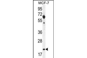 hCG_1646420 Antibody (Center) (ABIN656075 and ABIN2845422) western blot analysis in MCF-7 cell line lysates (35 μg/lane). (CLDN25 Antikörper  (AA 99-128))