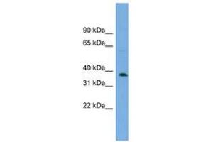 Image no. 1 for anti-Chromosome 17 Open Reading Frame 48 (C17orf48) (AA 179-228) antibody (ABIN6744185) (ADPRM Antikörper  (AA 179-228))