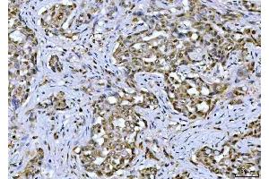 IHC analysis of TIF1 gamma using anti-TIF1 gamma antibody (ABIN3043492). (TRIM33 Antikörper  (AA 1001-1127))