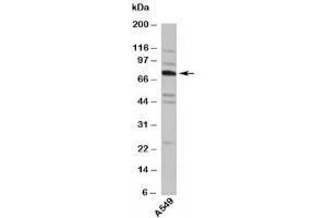 Western blot testing of human samples with TNFAIP2 antibody at 4ug/ml. (TNFAIP2 Antikörper  (Internal Region))