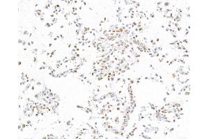 Immunocytochemistry (ICC) image for anti-Runt-Related Transcription Factor 2 (RUNX2) (AA 300-350) antibody (ABIN7795798) (Rekombinanter RUNX2 Antikörper  (AA 300-350))
