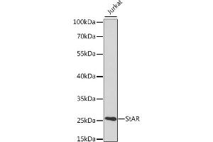 Western blot analysis of extracts of various cell lines, using StAR antibody (ABIN3021302, ABIN3021303, ABIN3021304 and ABIN6214574) at 1:400 dilution. (STAR Antikörper  (AA 64-285))