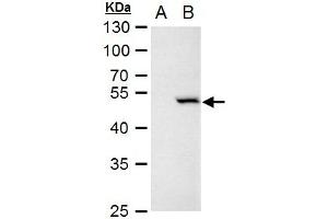 WB Image Chk1 antibody [C1C2-6], Internal detects Chk1 protein by western blot analysis. (CHEK1 Antikörper)