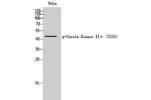 Western Blotting (WB) image for anti-Casein Kinase 2 alpha 1 (CSNK2A1) (pTyr255) antibody (ABIN3173062) (CSNK2A1/CK II alpha Antikörper  (pTyr255))