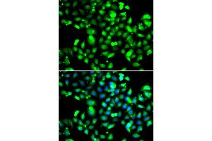 Immunofluorescence analysis of U2OS cells using GBP1 antibody (ABIN5974159).