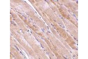 Immunohistochemistry of emerin in human skeletal muscle tissue with emerin antibody at 2. (Emerin Antikörper  (N-Term))