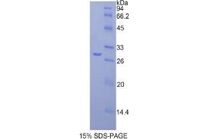 SDS-PAGE analysis of Mouse Fatty Acid Synthase Protein. (Fatty Acid Synthase Protein (FASN) (partial) (His tag))