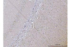 IHC analysis of VPS53 using anti-VPS53 antibody (ABIN7599731). (VPS53 Antikörper  (AA 11-699))