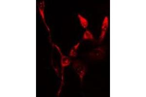 ABIN6276547 staining  Hela cells by IF/ICC. (FTH1 Antikörper  (C-Term))