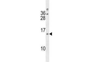 DUSP13 antibody western blot analysis in A2058 lysate (DUSP13 Antikörper  (AA 147-173))