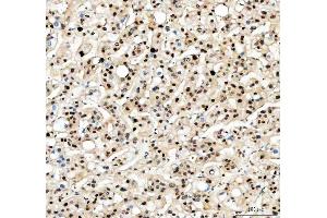 IHC analysis of PCNA using anti-PCNA antibody (ABIN7599179).