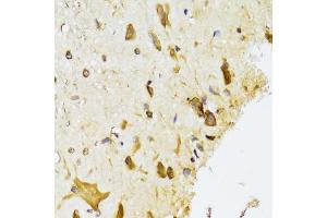 Immunohistochemistry of paraffin-embedded rat spinal cord using RPL13 Antibody (ABIN2559760) at dilution of 1:100 (40x lens). (RPL13 Antikörper)