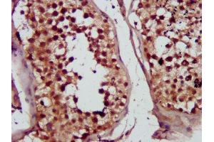IHC image of ABIN7149997 diluted at 1:300 and staining in paraffin-embedded human testis tissue performed on a Leica BondTM system. (MVD Antikörper  (AA 69-221))