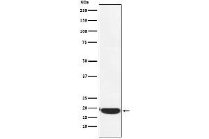 Western blot analysis of PERP expression in A431 cell lysate.
