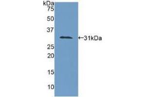 Western blot analysis of recombinant Human COL4a1. (COL4A1 Antikörper  (AA 1444-1669))