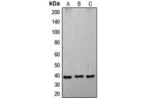 Western blot analysis of CD178 expression in A549 (A), K562 (B), HL60 (C) whole cell lysates. (FASL Antikörper  (Center))
