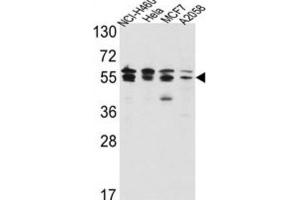 Western Blotting (WB) image for anti-IMP (Inosine 5'-Monophosphate) Dehydrogenase 2 (IMPDH2) antibody (ABIN3003184)