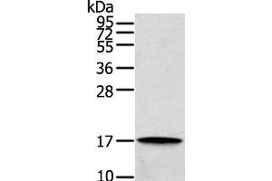 Western Blot analysis of Human cecum carcinoma tissue using REG3A Polyclonal Antibody at dilution of 1:200 (REG3A Antikörper)