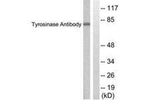 Western blot analysis of extracts from COS7 cells, treated with UV 30', using Tyrosinase Antibody. (TYR Antikörper  (AA 471-520))