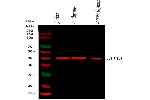 Western blot analysis of ADA using anti-ADA antibody (ABIN4886424). (ADA Antikörper  (AA 135-363))