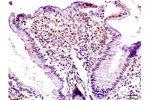 Formalin-fixed and paraffin embedded rat colon labeled with Anti Lpin1 Polyclonal Antibody, Unconjugated (ABIN672831) at 1:200 followed by conjugation to the secondary antibody and DAB staining. (Lipin 1 Antikörper  (AA 201-300))