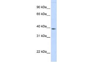 Western Blotting (WB) image for anti-Family with Sequence Similarity 76, Member B (FAM76B) antibody (ABIN2459566) (FAM76B Antikörper)