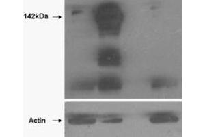 HEK293 overexpressing TANK1 (lane 2) and TANK2 (lane 4) and probed with ABIN2560296 (mock transfection in first lane).