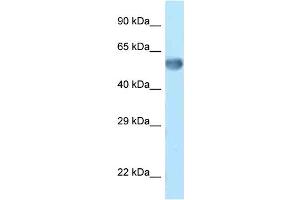 WB Suggested Anti-Zkscan14 Antibody Titration: 1. (ZNF394 Antikörper  (C-Term))