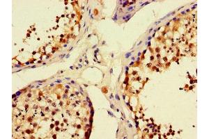 Immunohistochemistry of paraffin-embedded human testis tissue using ABIN7166245 at dilution of 1:100 (UNC13C Antikörper  (AA 414-645))