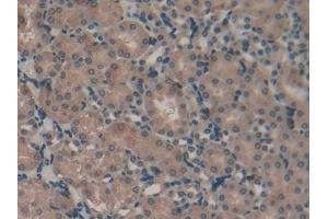 Immunohistochemistry (IHC) image for anti-Vascular Endothelial Growth Factor C (VEGFC) (AA 108-223) antibody (ABIN7429439)