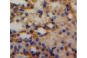 Used in DAB staining on fromalin fixed paraffin-embedded Kidney tissue (Luteinizing Hormone Antikörper  (AA 25-120))