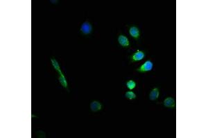 Immunofluorescence staining of A549 cells with ABIN7153853 at 1:66, counter-stained with DAPI. (GFAP Antikörper  (AA 292-432))