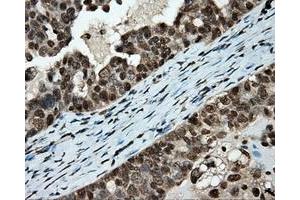 Immunohistochemical staining of paraffin-embedded colon tissue using anti-APP mouse monoclonal antibody. (APP Antikörper)
