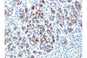 Formalin-fixed, paraffin-embedded human Pancreas stained with Alpha-1-Antichymotrypsin Mouse Monoclonal Antibody (AACT/1451) (SERPINA3 Antikörper  (AA 49-187))
