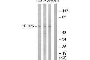 Western blot analysis of extracts from HeLa cells, Jurkat cells and A549 cells, using CBCP6 antibody. (AGBL4 Antikörper  (C-Term))